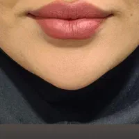 مطب دکتر پاک منش|خدمات آرایشگری و زیبایی|بهبهان, |دیوار