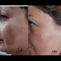 سلام مشاور پوست مو هستم