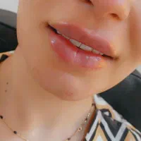مدل برای تزریق ژل و بوتاکس فقط هزینه مواد|خدمات آرایشگری و زیبایی|لنجان, |دیوار