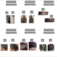 روغن ترکیبی مو درمان ریزش مو|آرایشی، بهداشتی، درمانی|برازجان, |دیوار