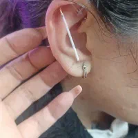 تتو بدن.پرسینگ برداشتن زگیل برداشتن خال