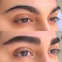 میکروبلیدینگ‌کرکی مویی،فیبروز کرکی مویی|خدمات آرایشگری و زیبایی|تربت‌حیدریه, مظفریه|دیوار