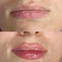 تخفیف تکرارنشدنی ۱۹ شهریور|خدمات آرایشگری و زیبایی|رشت, چله خانه|دیوار