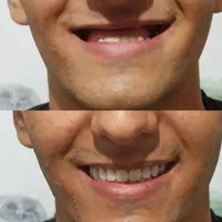 («دندانسازی زاهدی»)|خدمات آرایشگری و زیبایی|ارومیه, |دیوار