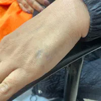 پاک کردن تتوخالکوبی/بدن ابرو لب چشم/بوتاکس کیوسویچ|خدمات آرایشگری و زیبایی|اصفهان, عباسآباد|دیوار