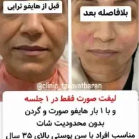 هایفو۷و۱۲بعد/حجم‌سینه‌باسن/پی‌آر‌پی/لیزرموهای زائد