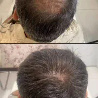 تبدیل رویا به واقعیت