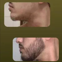 توهم ۱۸ سالت شده ریش نداری