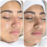 پاکسازی پوست