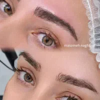 فیبروز طبیعی وشیدینگ لب بدون درد