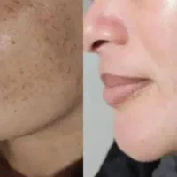 لک صورت