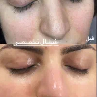فیشیال و پاکسازی تخصصی تربت جام