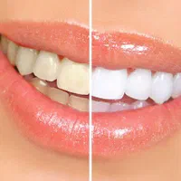 خدمات دندانپزشکی با شرایط ویژه