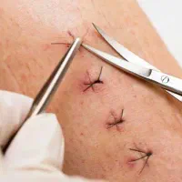 انجام خدمات پرستاری در منزل