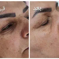 پاکسازی تخصصی صورت|خدمات آرایشگری و زیبایی|محمدشهر, محمدشهر|دیوار