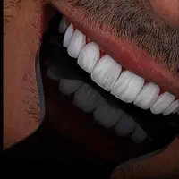 ایمپلنت اوردنچر کامپوزیت دندان روکش دندان لمینت|خدمات آرایشگری و زیبایی|تهران, ستارخان|دیوار