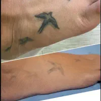 لیزر مو زائد/لیزر تتو/پاک کردن تتو/روشن سازی پوست|خدمات آرایشگری و زیبایی|اصفهان, خلجا|دیوار