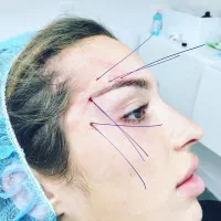 مدل نخ مونو دوسوزنه کاگ لیفت|خدمات آرایشگری و زیبایی|تهران, مرزداران|دیوار
