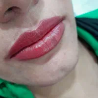 میکروبلیدینگ شیدینگ لب خط چشم تتو بدن و ریموو