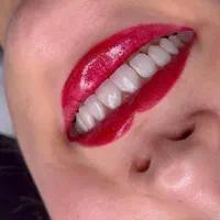 دندانپزشکی/کامپوزیت/لمینیت/ایمپلنت|خدمات آرایشگری و زیبایی|تهران, قبا|دیوار