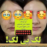 لاغری فقط فقط با عسل|خوردنی و آشامیدنی|دلگان, |دیوار