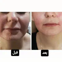 کلینیک پوست و مو|خدمات آرایشگری و زیبایی|تهران, خانی آباد نو شمالی|دیوار