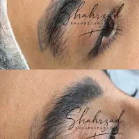 اجاره ورنت لیزر کیوسوییچپیکوشور بااپراتور حرفه ای|پزشکی|تهران, اقدسیه|دیوار