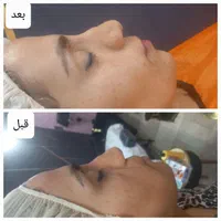 فشیال و خدمات جوانسازی ارغوان بر پایه علم نوین|خدمات آرایشگری و زیبایی|نیشابور, محله میدان باغات|دیوار