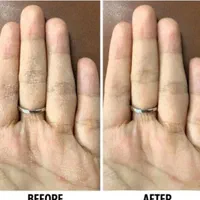 پماد ترک پا ودست