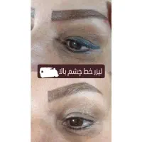 مرکز ریمو،پاک کردن،ریموو تتوابرو.بدن.خط چشم بالیزر|خدمات آرایشگری و زیبایی|شیراز, فرهنگ شهر|دیوار
