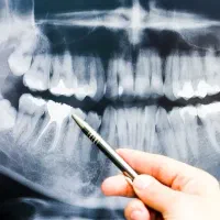 خدمات دندانپزشکی