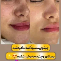 فیشال و پاکسازی تخصصی پوست