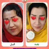 ژل کرم رویال|آرایشی، بهداشتی، درمانی|نورآباد ممسنی, |دیوار