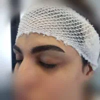 کاشت مو و ابرو به روش شیرازی و با قیمت باور نکردنی|خدمات آرایشگری و زیبایی|آستانه اشرفیه, |دیوار
