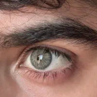 فروش لنز زیبایی باکیفیت