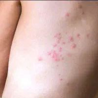 خدمات سمپاشی %100تضمینی تمام نقاط تهران|خدمات نظافت|تهران, آهنگ|دیوار