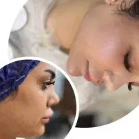 فیلر لب،چونه،گونه،فول فیس،باسن|خدمات آرایشگری و زیبایی|مشهد, سجاد شهر|دیوار