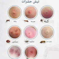 سمپاشی ساس کنه کبوتری جوندگان تضمینی|خدمات نظافت|محمدیه-قزوین, |دیوار