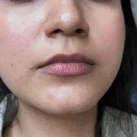 ژل و بوتاکس|خدمات آرایشگری و زیبایی|قاسم‌آباد (خواف), |دیوار