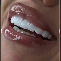 دستیار دندانپزشک
