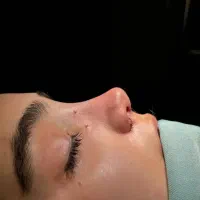 اف ویژه جراحی بینی در اهواز