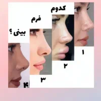 عمل بینی نقد و اقساط ، با هزینه مناسب|خدمات آرایشگری و زیبایی|تهران, میدان ولیعصر|دیوار