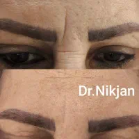 تخفیف ویژه افتتاحیه کلینیک زیبایی دکتر نیک جان|خدمات آرایشگری و زیبایی|رشت, گلسار|دیوار