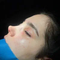 عمل بینی اقساطی|خدمات آرایشگری و زیبایی|تهران, الهیه|دیوار