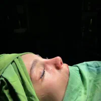 تخفیف ویژه عمل بینی به مناسبت روز زن