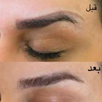 پاککردن تاتو صورت و بدن.تخفیف تا پایان هفته|خدمات آرایشگری و زیبایی|کرمانشاه, |دیوار