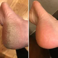 مدل ترمیم و کاشت مژه، اکستیشن،پدیکور|خدمات آرایشگری و زیبایی|اندیشه, اندیشه فاز ۱|دیوار