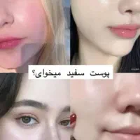 فرمول سفید کننده قوی بدون بازگشت  تضمینی