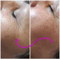 فیشال صورت بانوان و آقایان محترم و فیشال بادی|خدمات آرایشگری و زیبایی|اصفهان, دشتستان|دیوار