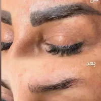 ،لیزر تاتو و جوانسازی پوست تضمینی